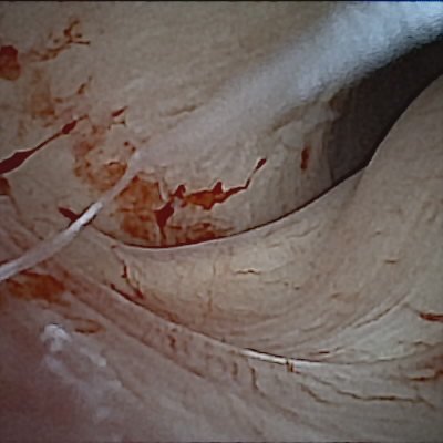 View of tissue inside the joint